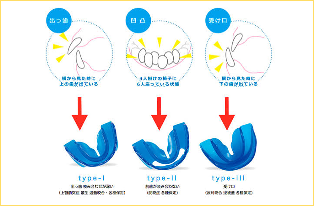 invisalign